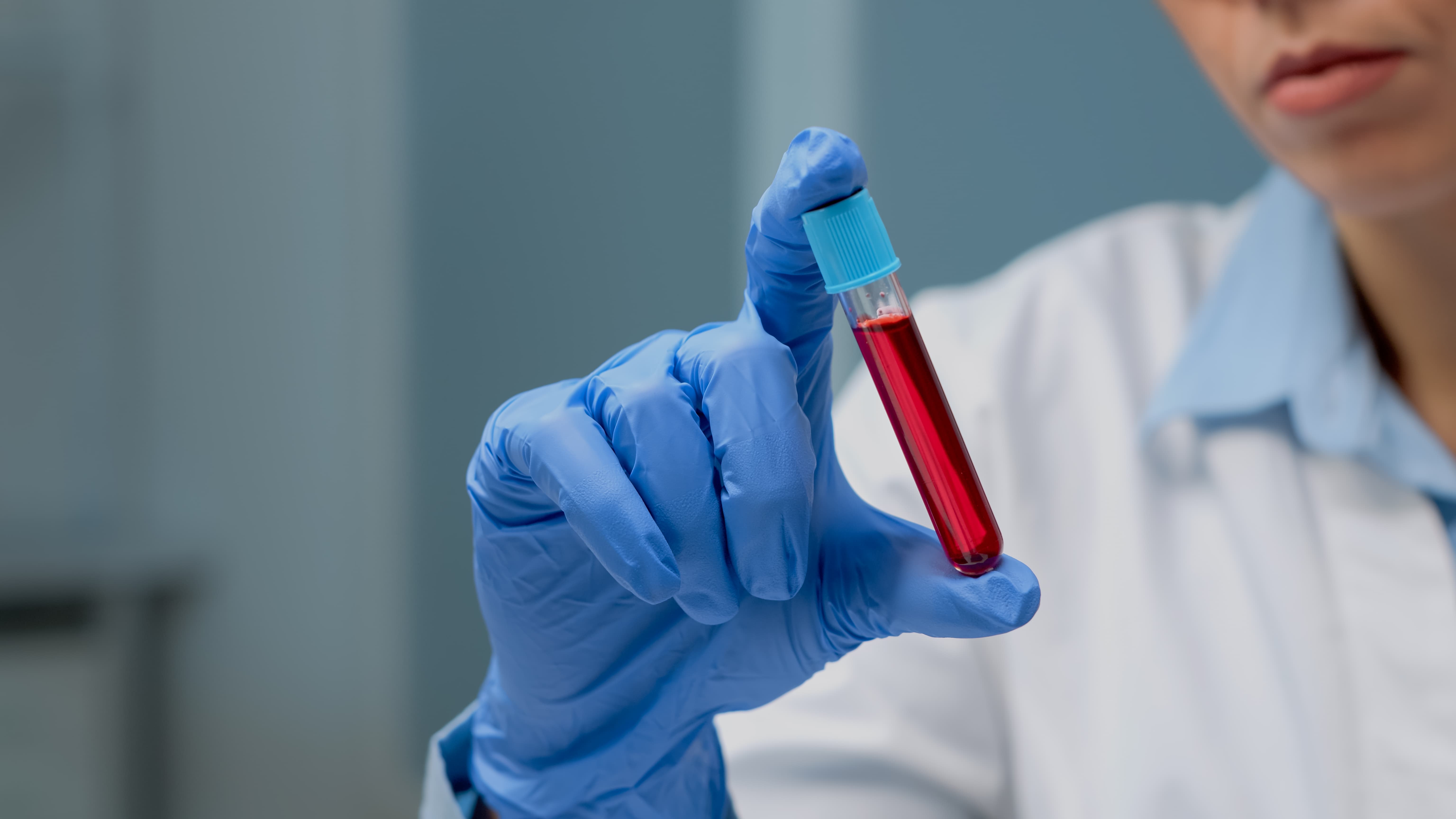 Waterloo study links blood patterns to spinal injury prognosis
