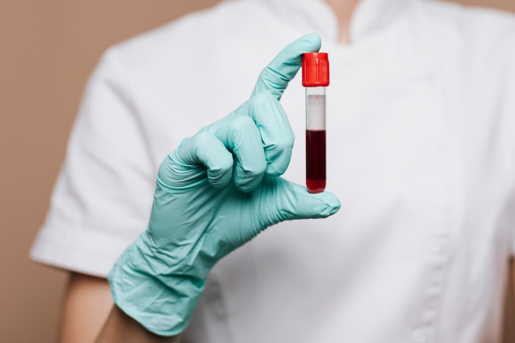 AI-backed biosensors from Liverpool researchers could transform Alzheimer's diagnosis with portable, low-cost blood testing tools.